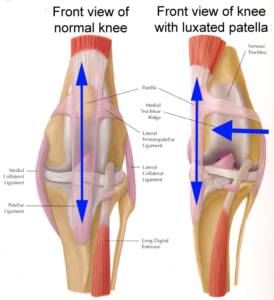 patella